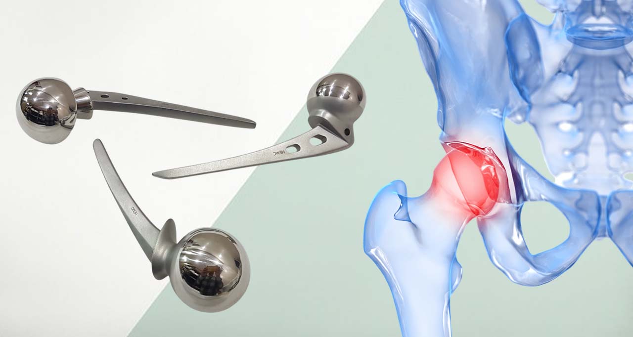 Hip Prosthesis and Hip Implants