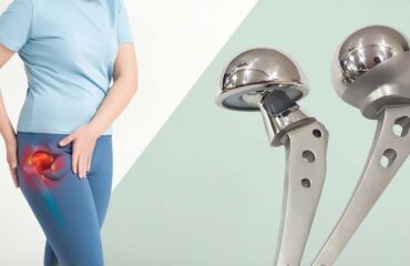 Hip prosthesis India