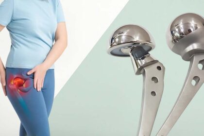 Hip prosthesis India