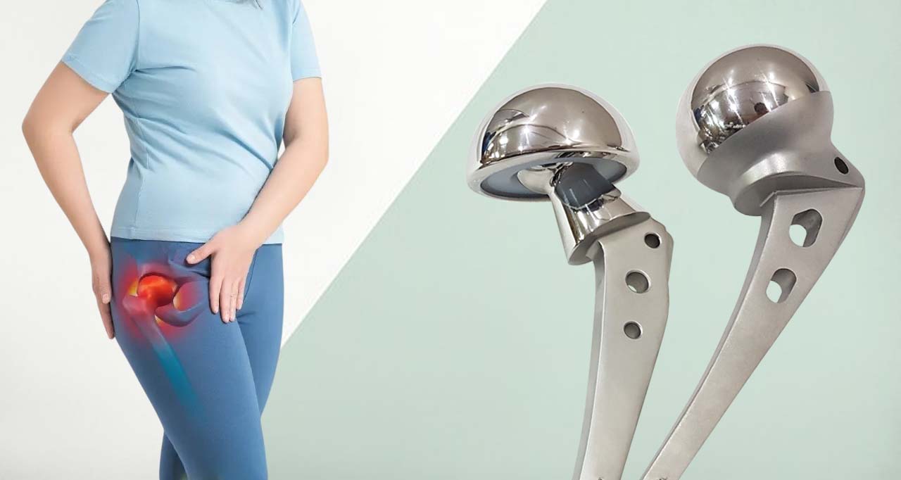 Hip prosthesis India