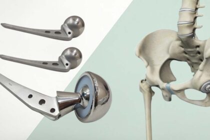 Hip Replacement System