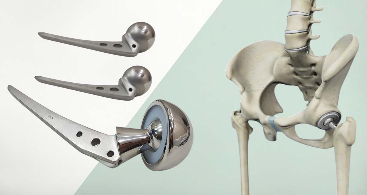 Hip Replacement System