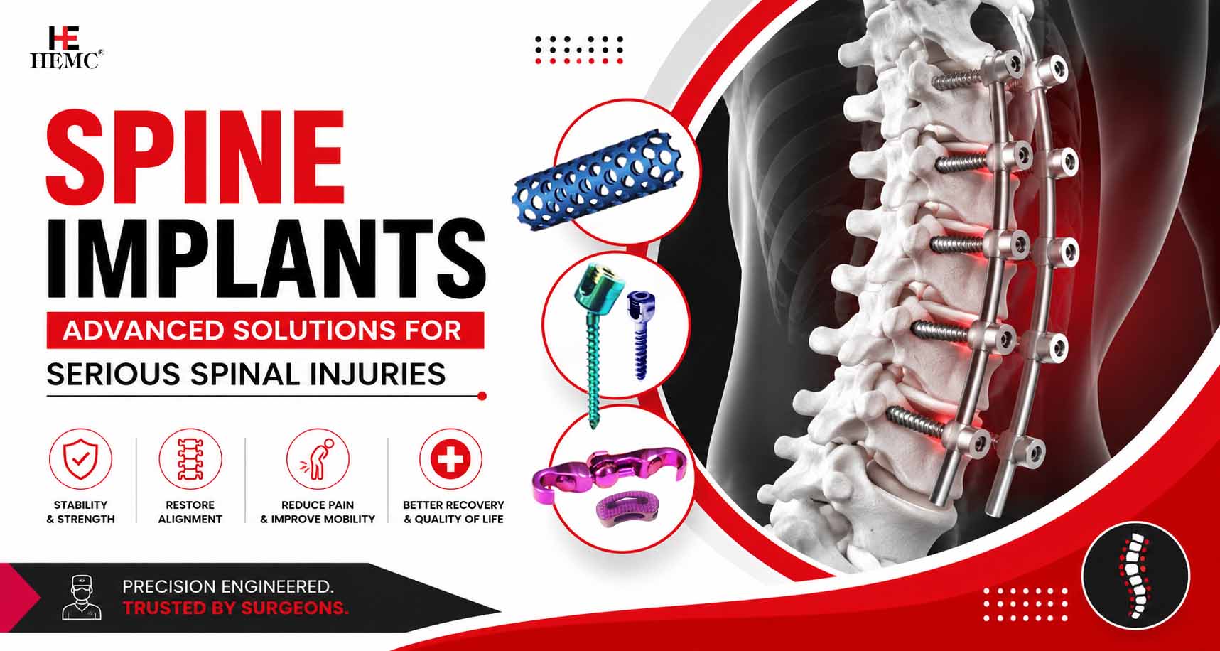Spine Implants India - Complete Treatment Guide Spine Implants