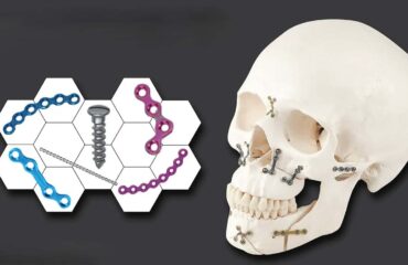 Maxillofacial Implants in India