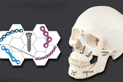 Maxillofacial Implants in India