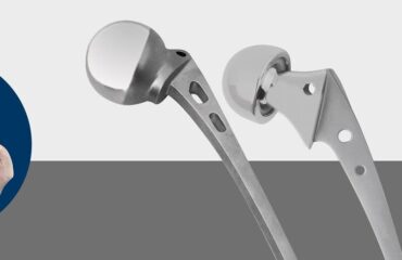 Importance of hip prosthesis in the orthopedic industry