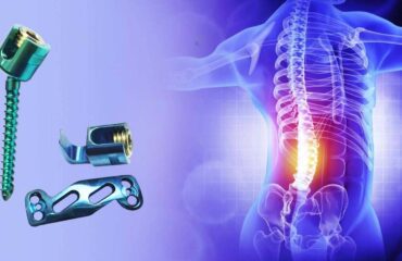 Spine Implants – It's Types and Purpose in Health Care