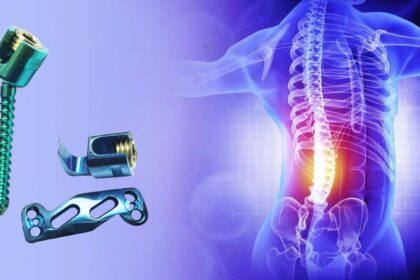 Spine Implants – It's Types and Purpose in Health Care