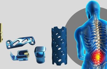 Spine Implants