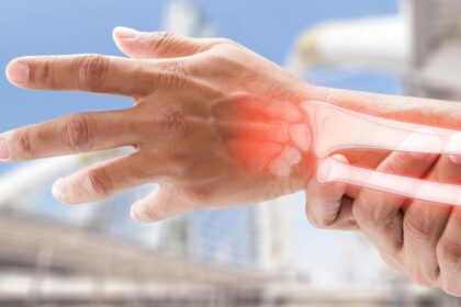 symptoms of wrist fractures
