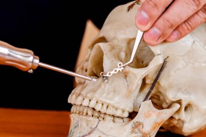 Maxillofacial Implant Surgery