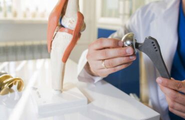 Types of Hip Implants You Can Buy In India