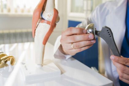 Types of Hip Implants You Can Buy In India