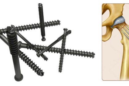 A Guide to Cannulated Screws