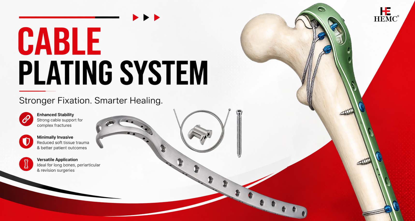 Cable Plating System – A Detailed Overview Cable Plating System
