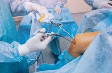 Arthroscopy Manufacturer and Exporter