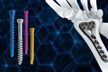 Locking Screws and Plates