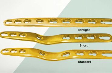 Secure Lock Wrist Fusion Plates