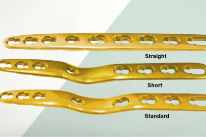 Secure Lock Wrist Fusion Plates