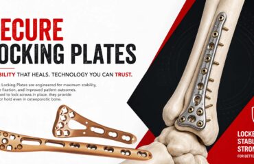 Top Secure Locking Plates Manufacturer in India Locking Plates