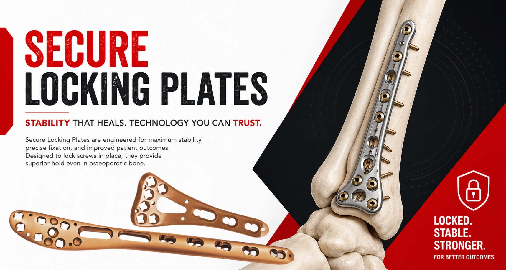 Top Secure Locking Plates Manufacturer in India Locking Plates