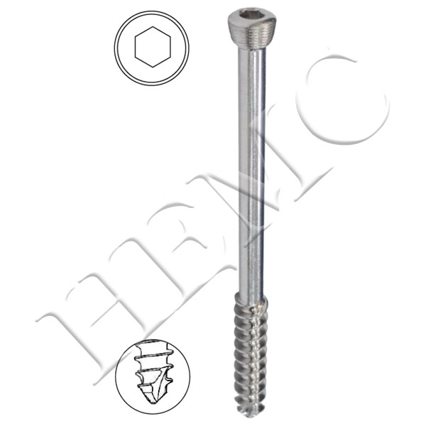6.5mm SECURE LOCKING CANCELLOUS SCREWS, 32mm THREAD, SELF TAPPING