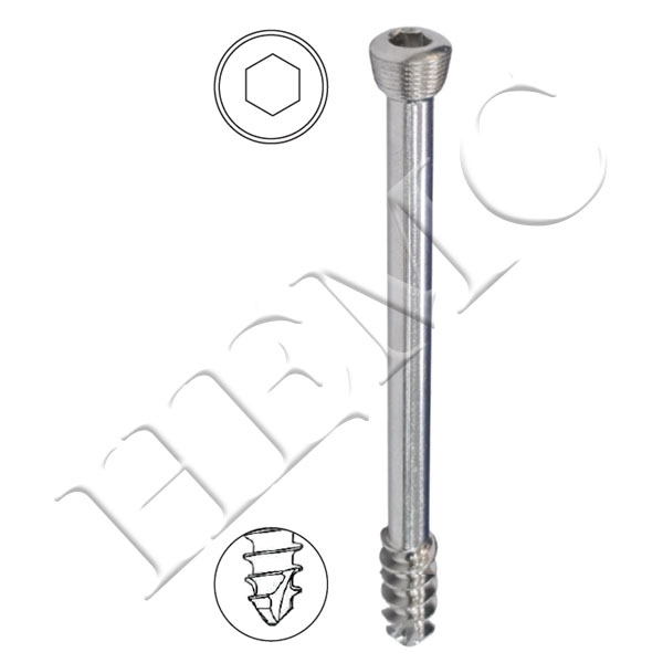 5.0mm SECURE LOCKING CANCELLOUS SCREWS, 16mm THREAD, SELF TAPPING