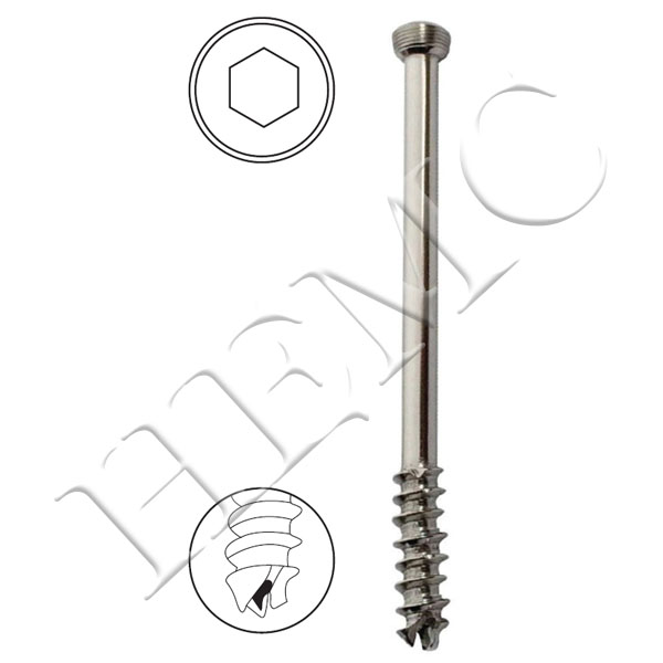 6.5mm SECURE LOCKING CANCELLOUS, CANNULATED SCREWS, 32mm THREAD