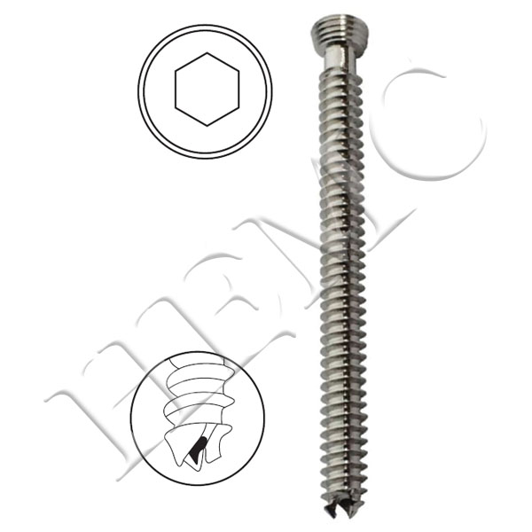 6.5mm SECURE LOCKING CANCELLOUS, CANNULATED SCREWS, FULL THREAD