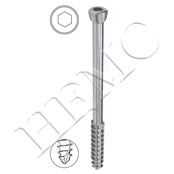 5.0mm SECURE LOCKING CANCELLOUS SCREWS, 32mm THREAD, SELF TAPPING