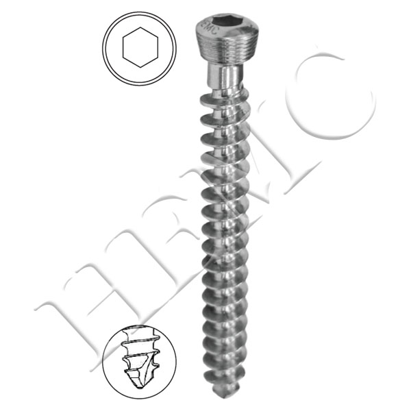 5.0mm SECURE LOCKING CANCELLOUS SCREWS, FULL THREAD, SELF TAPPING