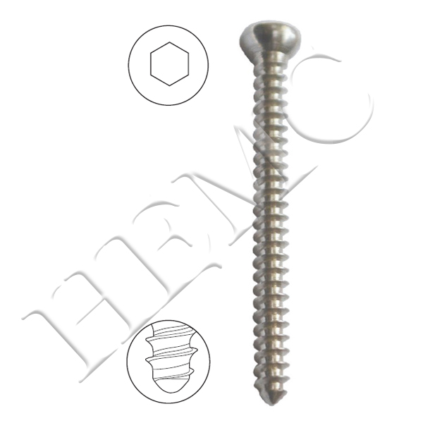 2.7mm CORTICAL SCREW, PLAIN