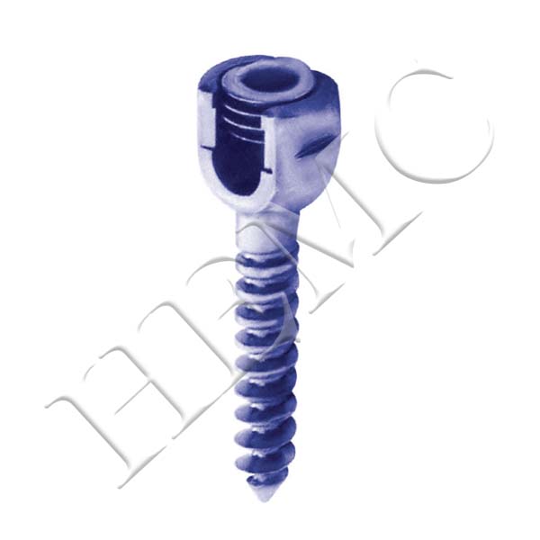 MONO-AXIAL SINGLE LOCK SCREW, TITANIUM