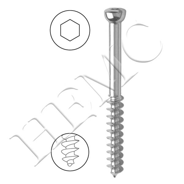 6.5mm CANCELLOUS SCREW, 32mm THREAD