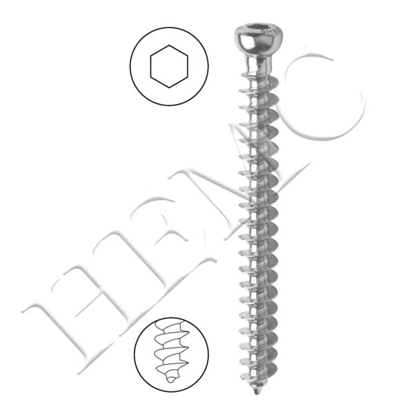 6.5mm CANCELLOUS SCREW, FULL THREAD