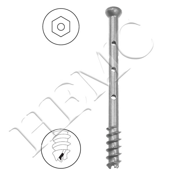 6.5mm CANCELLOUS CANNULATED SCREW, 16mm THREAD, PERFORATED SHAFT