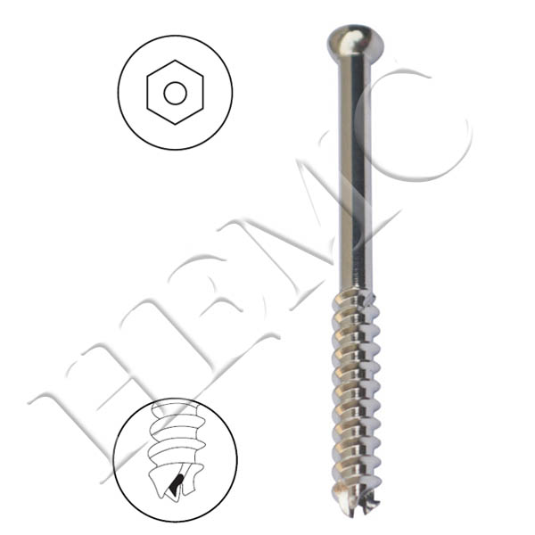 6.5mm CANCELLOUS CANNULATED SCREW, 32mm THREAD