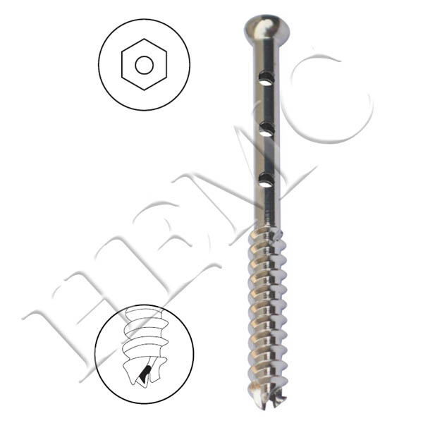 6.5mm CANCELLOUS CANNULATED SCREW, 32mm THREAD, PERFORATED SHAFT