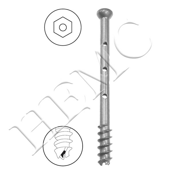 7.0mm LARGE CANCELLOUS CANNULATED SCREW, 16mm THREAD, PERFORATED SHAFT