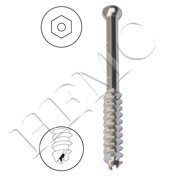 7.0mm LARGE CANCELLOUS CANNULATED SCREW, 32mm THREAD