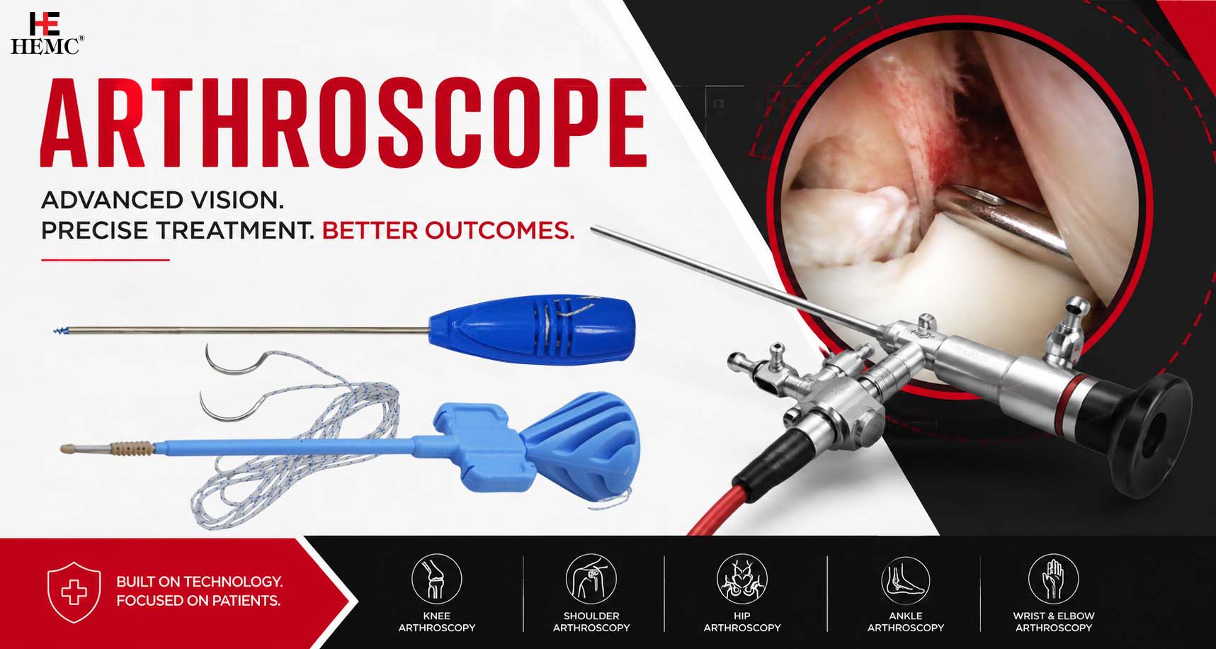 Arthroscope - Transforming Modern Orthopaedic and Sports Injury Surgery Arthroscope