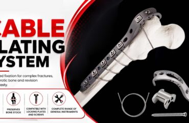 Cable Plating System - A Modern Solution in Orthopaedic Implants Cable Plating System