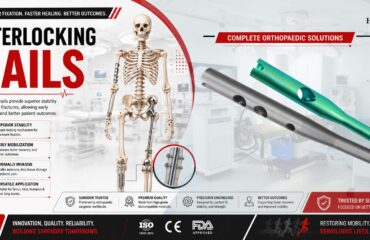 Explore Trusted Interlocking Nails for Safe Surgery Interlocking Nails