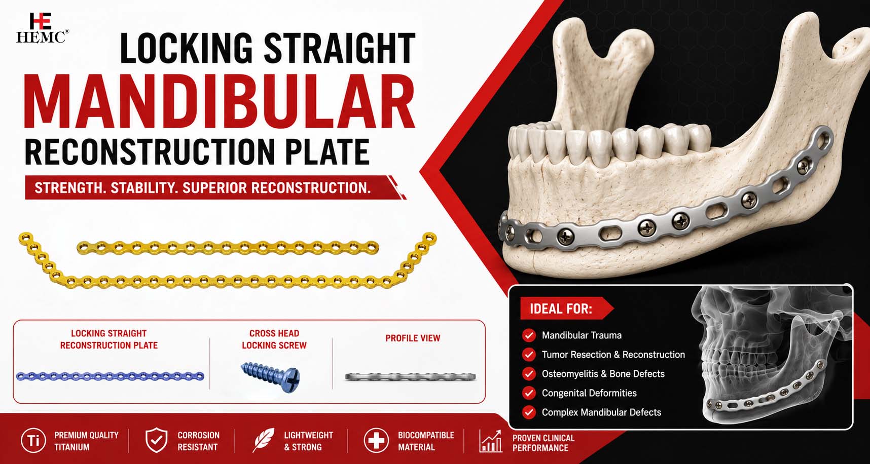 Locking Straight Mandibular Reconstruction Plate for Advanced Jaw Reconstruction Locking Straight Mandibular Reconstruction Plate