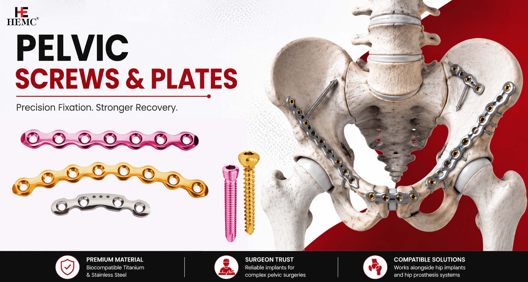 Pelvic Screws and Plates