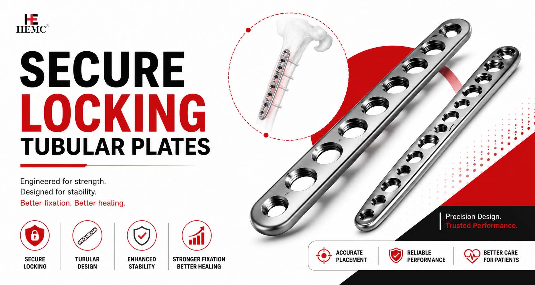 Secure Locking Tubular Plates Secure Locking Tubular Plate