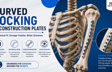 Curved Locking Reconstruction Plates