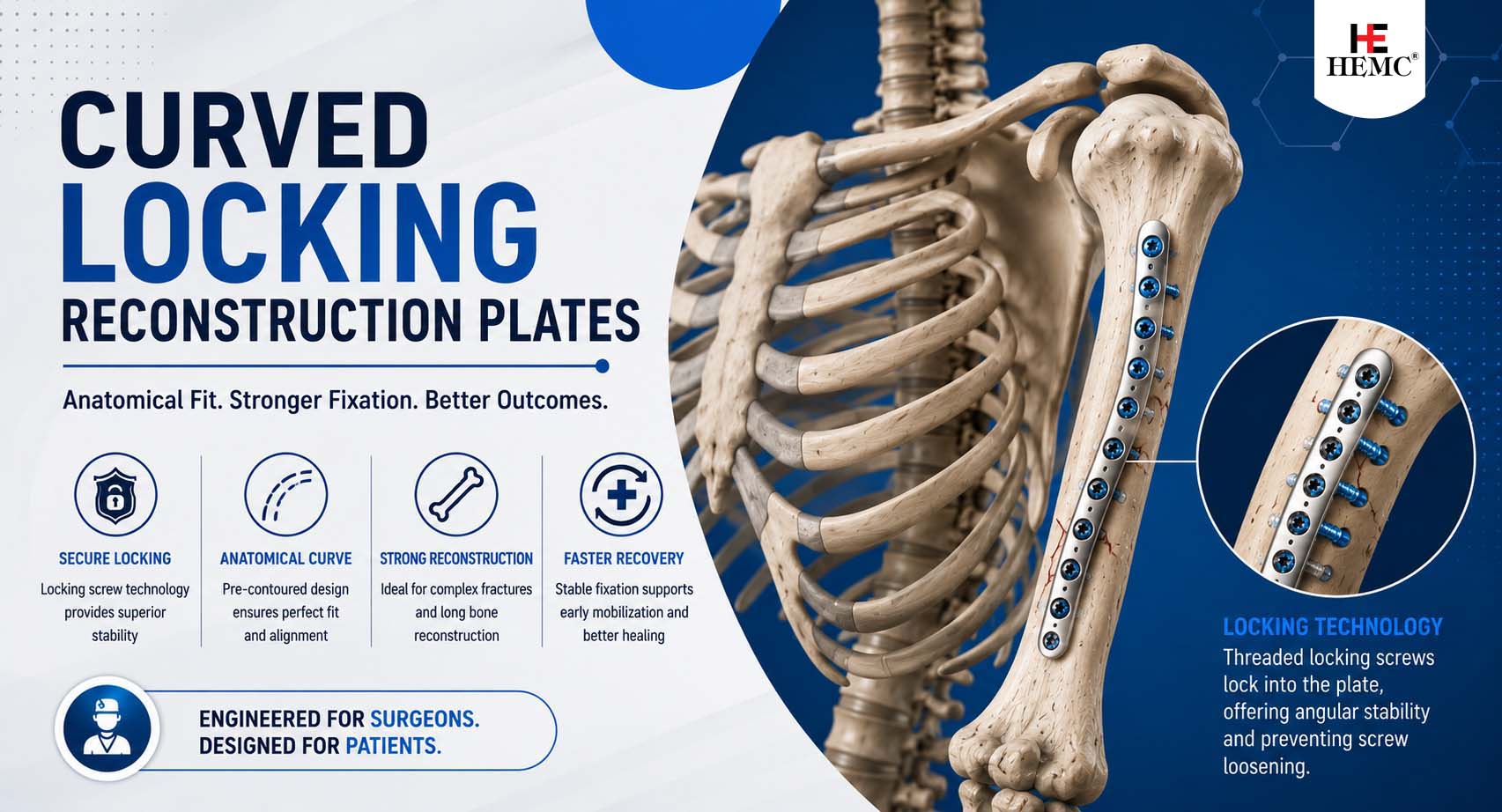 Curved Locking Reconstruction Plates