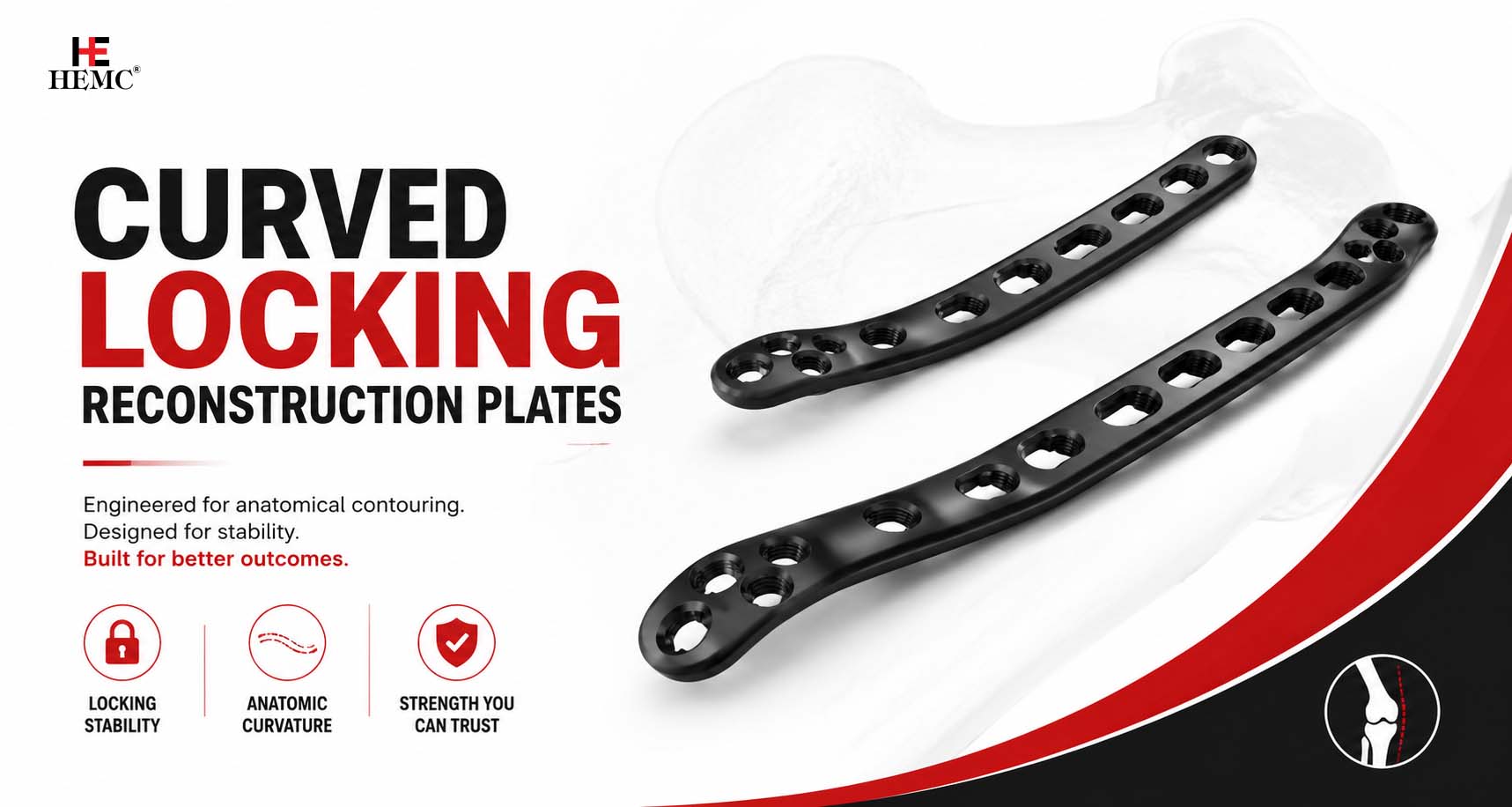 The Role of Curved Locking Reconstruction Plates in Trauma Surgery