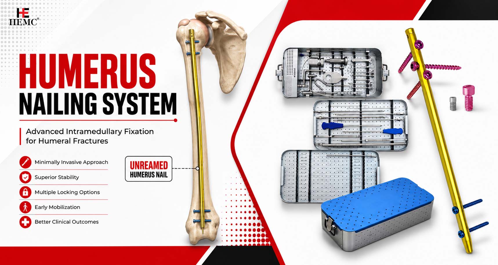Humerus Nailing System
